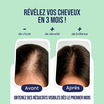 Gummies Anti-Chute de Cheveux 60 gélules Myriam K